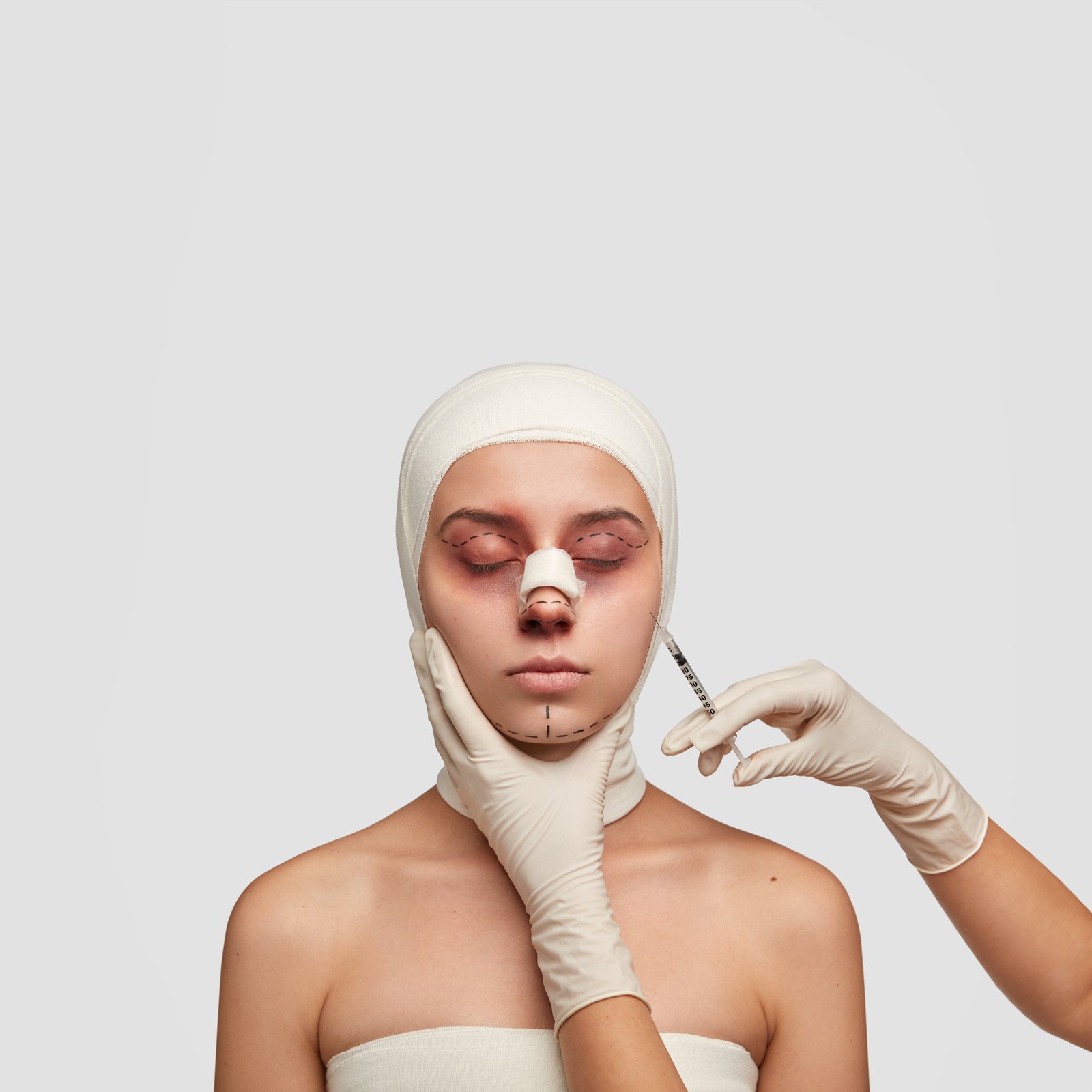 Suture Removal